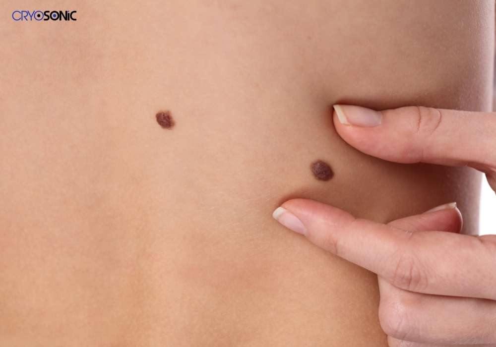 Infection Risk and Poor Aftercare Romford