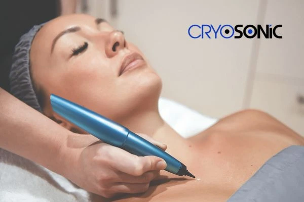 Cryosonic lesion removal prices book today! Romford