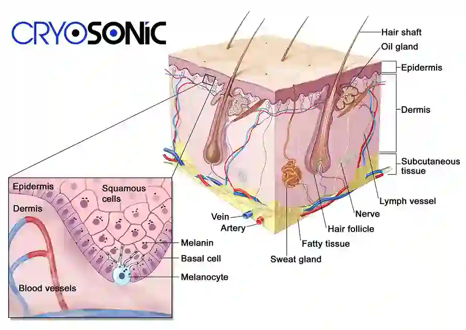 How Cryotherapy Stimulates Melanocyte Activity  Romford